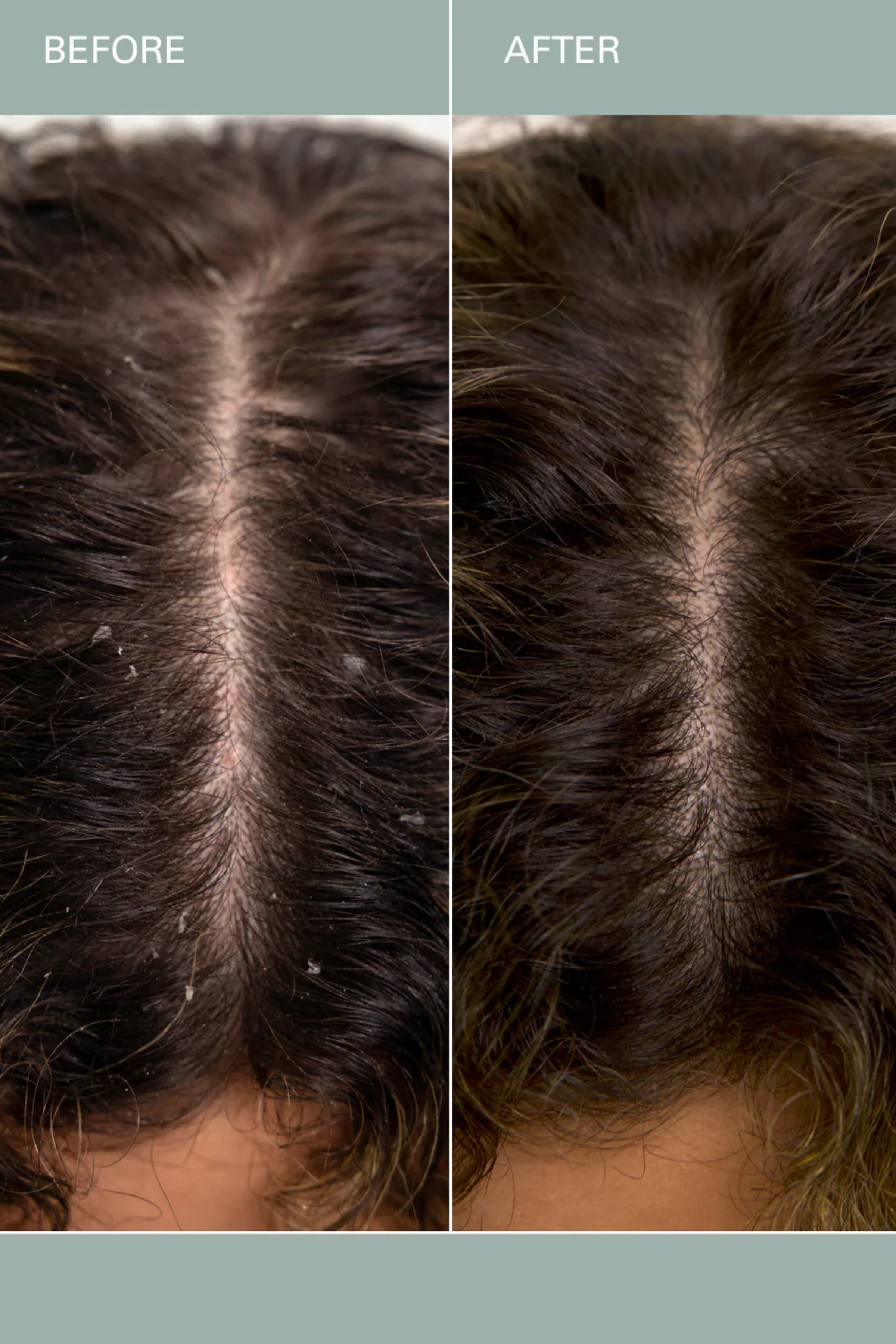 Salt Scalp Scrub - Image 5